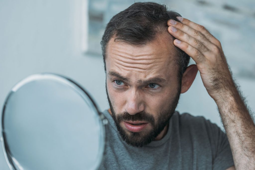 2 Techniques For Hair Restoration